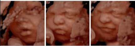 Ecografía 4D — Imagen 1