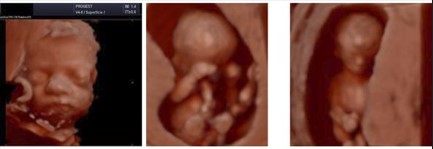 Ecografía 4D — Imagen 10