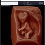 Ecografía 4D — Imagen 11