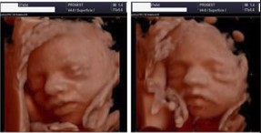 Ecografía 4D — Imagen 12