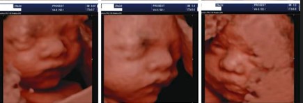 Ecografía 4D — Imagen 13