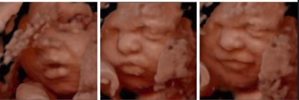 Ecografía 4D — Imagen 15