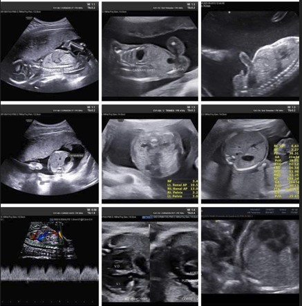 Ecografía 4D — Imagen 23